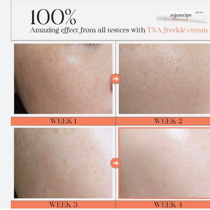 Pestlo Rejurecipe TXA Cream 30ml