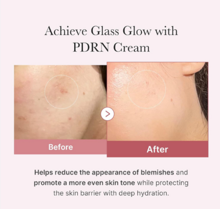 Medicube PDRN Pink Hyaluronic Moisturizing Cream 50ml