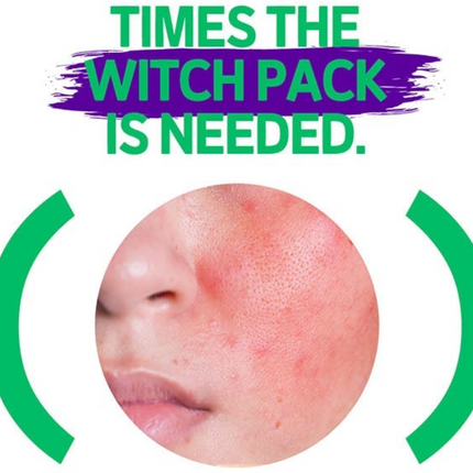 SKIN1004 - WITCH PACK Witch Pack 15g x 8τεμ.
